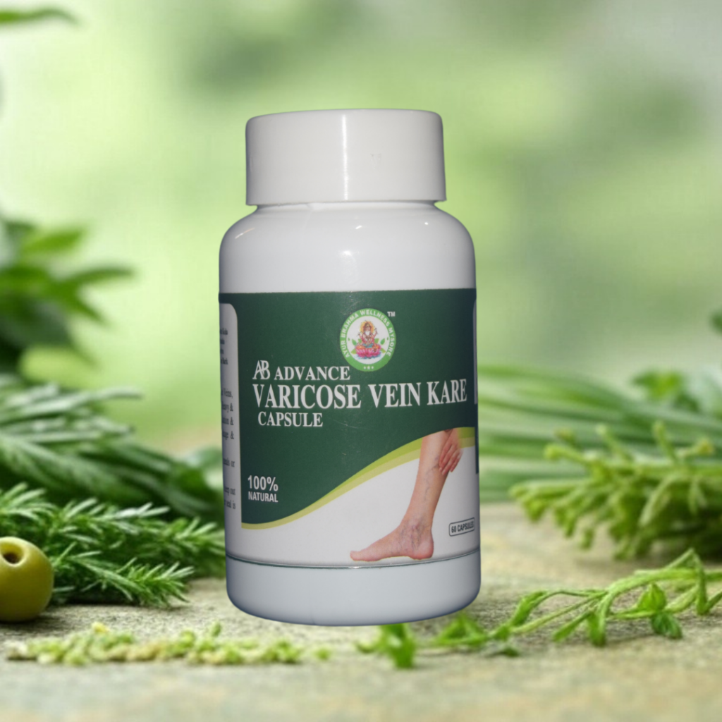 vericous veins prouct Ayurarogya Wellness mysore